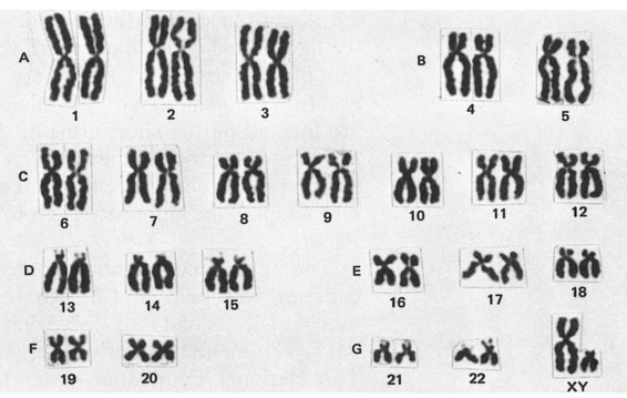 05_01_Karyotype_Denver_system.jpg