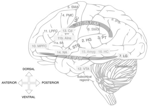 Figure 2.1 Anatomical locations of some grey matter regions involved in music perception and cognition. Shaded grey regions represent mesial structures, i.e., areas that are seen in cross-section rather than in the present surface view of the brain. Shaded orange regions represent white matter pathways. Colors of text represent general areas of the brain: Blue = temporal lobe; red = frontal lobe; brown = occipital lobe; green = parietal lobe; pink and violet = subcortical structures. See insert for color figure. 1. STG: Superior temporal gyrus 2. HG: Heschl’s gyrus 3. PT: Planum temporale 4. PMC: Premotor cortex 5. SMA: Supplementary motor area 6. MC: Motor cortex 7. LG: Lingual gyrus 8. SMG: Supramarginal gyrus 9. IPS: Intraparietal sulcus 10. MPFC: Medial prefrontal cortex 11. LPFC: Lateral prefrontal cortex a. BA: Broca’s area b. AIns: Anterior insula 12. VTA: Ventral tegmental area 13. Cd: Caudate 14. NA: Nucleus accumbens 15. Amyg: Amygdala 16. HC: Hippocampus 17. SLF/AF: Superior Longitudinal Fasciculus/Arcuate Fasciculus 18. IFOF: Inferior Frontal-Occipital Fasciculus