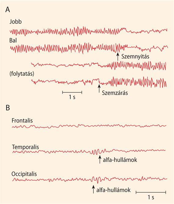 Az EEG-hullámok osztályozása