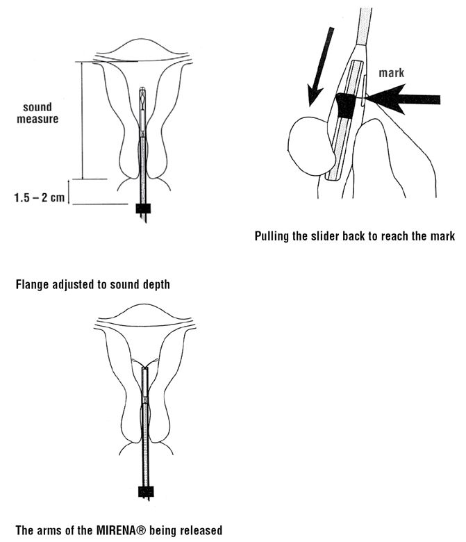 ManagingContraceptiontFINAL.pdf