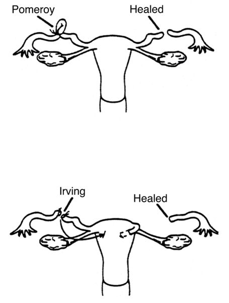 ManagingContraceptiontFINAL.pdf