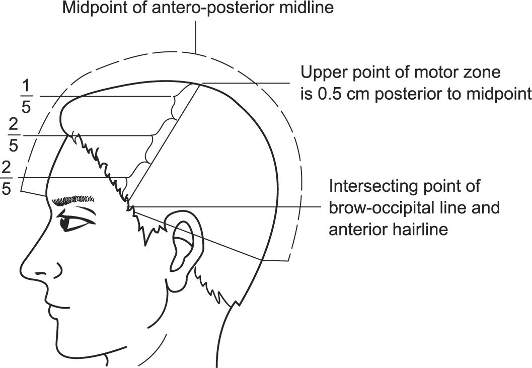 A978-1-84882-593-2_4_Fig32_HTML.jpg