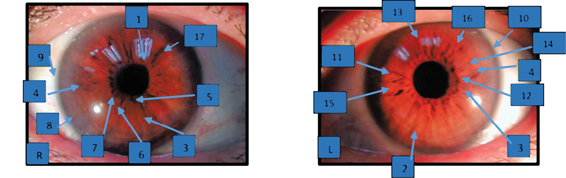 Hypertension%20-%20041416.tif