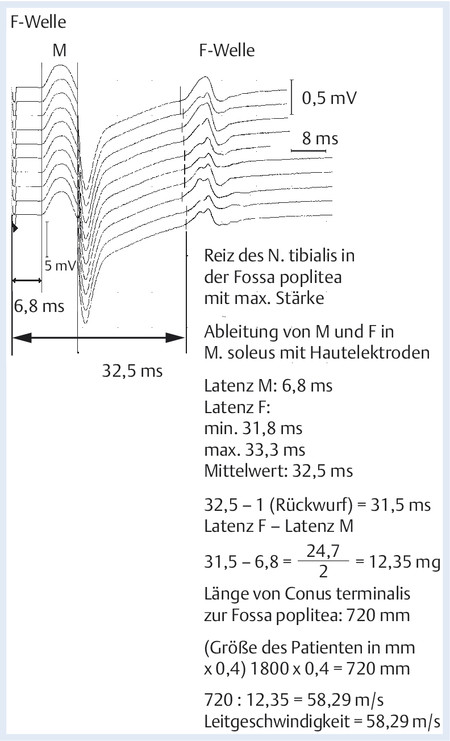 207490102_014_012.eps