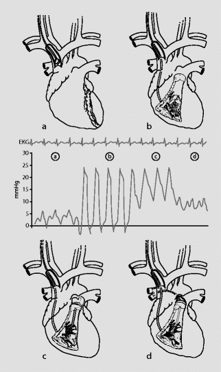 A189694_3_De_1_Fig1_HTML.gif