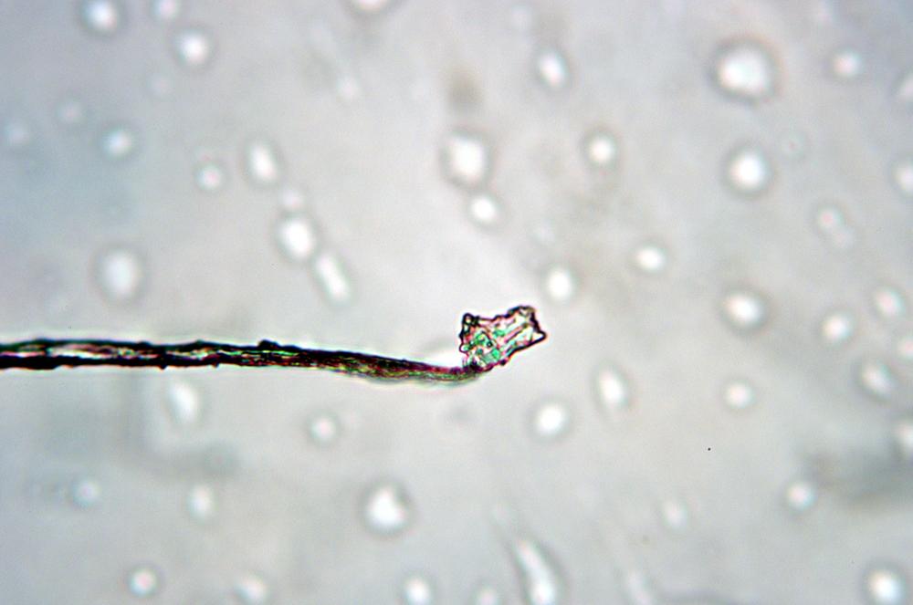 Sponge (Grantia sp.) spicule detail, 400X