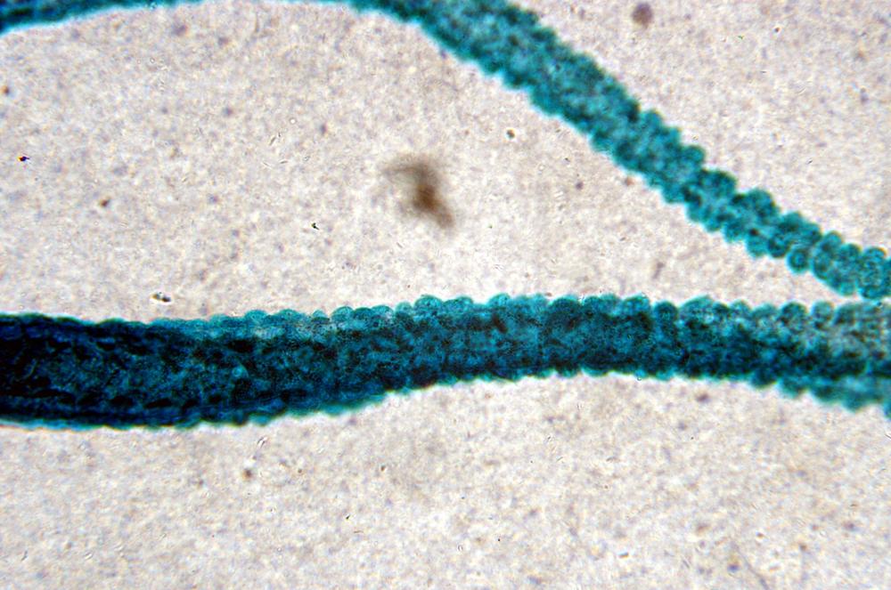 Hydra (Hydra sp.) wm cnidae detail, 100X