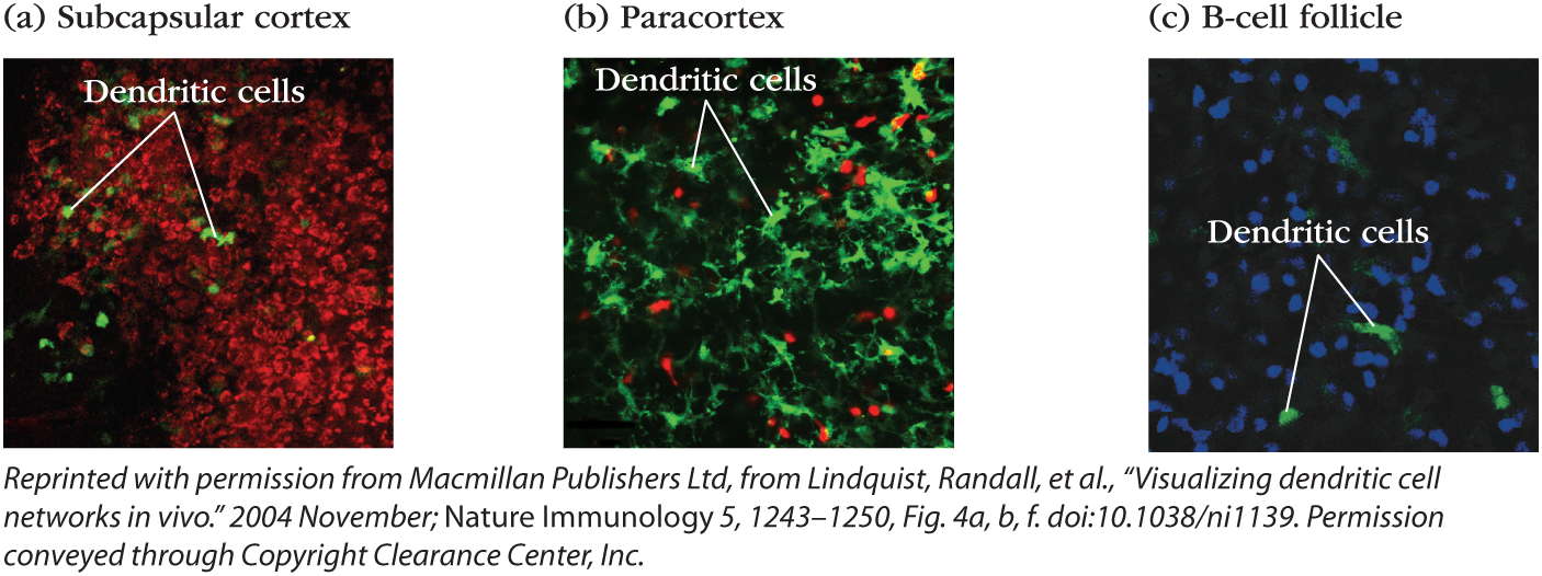 Three micrographs show dendritic cells in the subcapsular sinus, paracortex, and B-cell follicle.