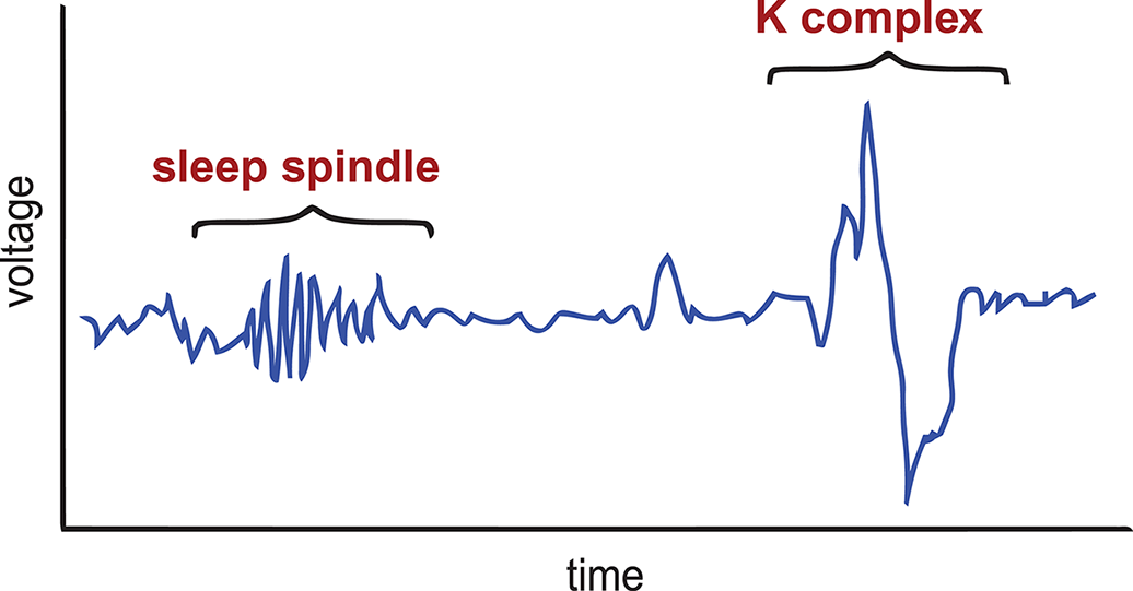 sleep spindle - tight, narrow grouping of small waves; K-complex - large upward and downward deviation from baseline