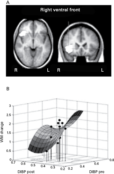 Figure 15.3