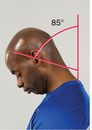 Figure 4.15 Normal range of motion for the head and neck.