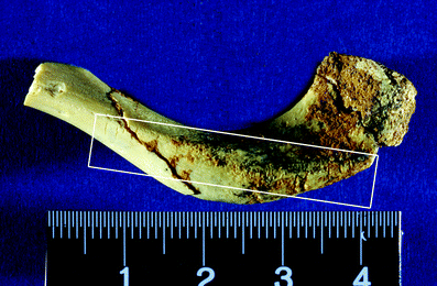 A367620_1_En_3_Fig106_HTML.gif