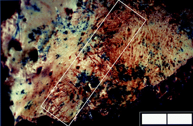 A367620_1_En_3_Fig107_HTML.gif