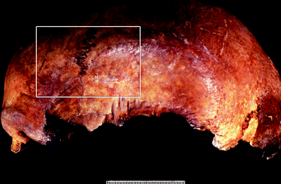 A367620_1_En_3_Fig108_HTML.gif