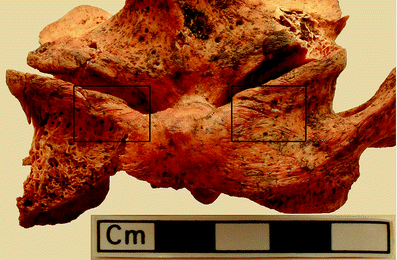 A367620_1_En_3_Fig111_HTML.gif