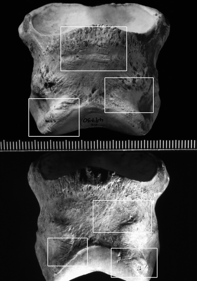 A367620_1_En_3_Fig112_HTML.gif