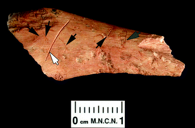 A367620_1_En_3_Fig243_HTML.gif