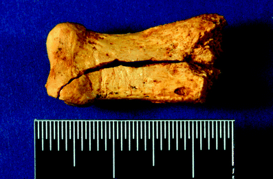 A367620_1_En_3_Fig60_HTML.gif