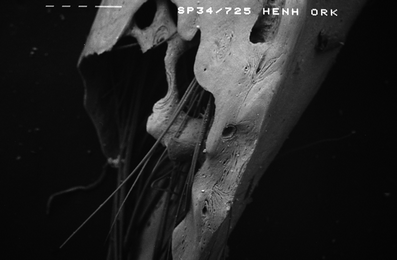 A367620_1_En_6_Fig80_HTML.gif