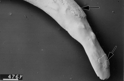 A367620_1_En_6_Fig95_HTML.gif