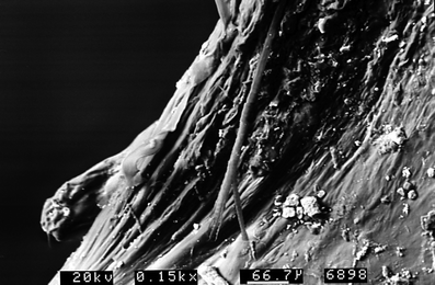 A367620_1_En_7_Fig126_HTML.gif