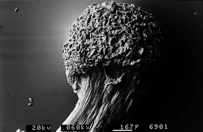 A367620_1_En_7_Fig127_HTML.gif