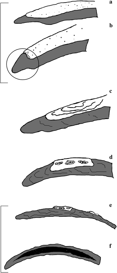 A367620_1_En_8_Fig4_HTML.gif