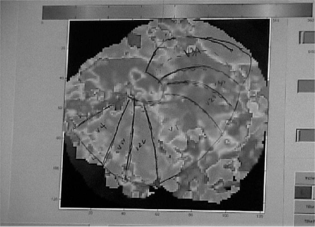 Figure 1. Phase map with the traced borders of visual areas.