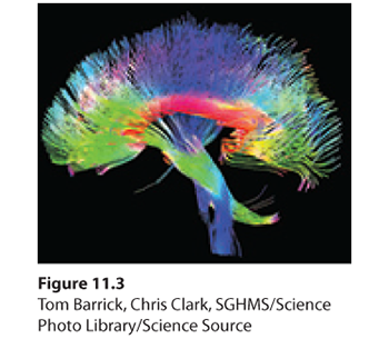 An illustration shows the cutting edge method to map the interconnecting neurons.