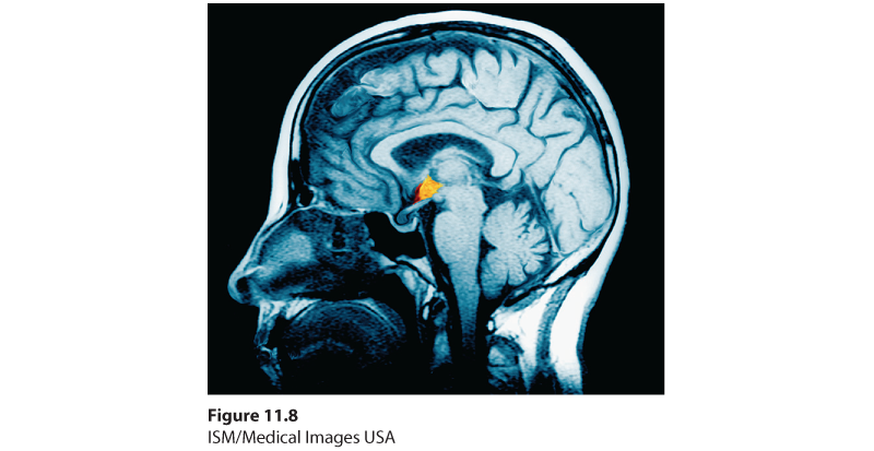 An M R I scan shows the hypothalamus highlighted in the human brain.