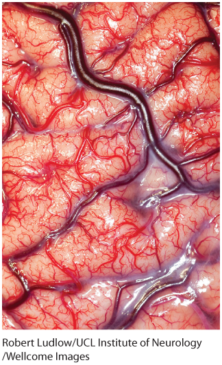 A photo shows a living human brain.