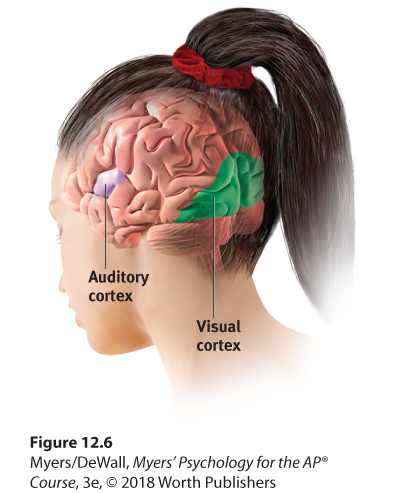 Diagram highlighting the visual and auditory cortex in the brain. The auditory cortex is highlighted in blue and the visual cortex in yellow.