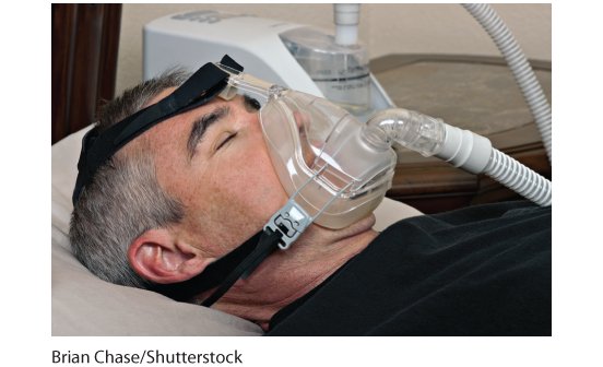 Photograph of a man with sleep apnea sleeping with a CPAP machine.