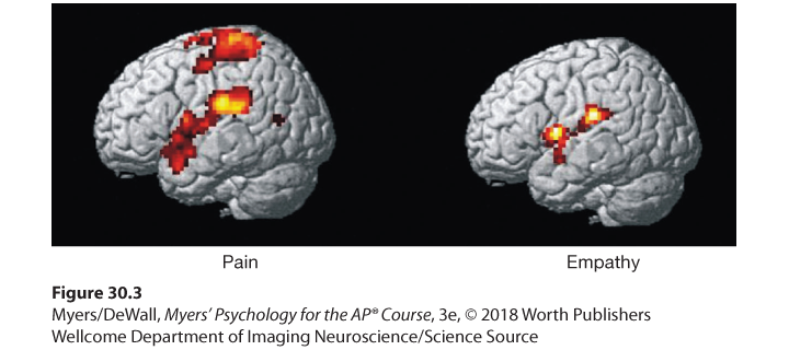 Brain scan showing brain activity related to pain and empathy.