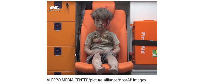 A photo shows Omran Daqneesh covered in bruises.