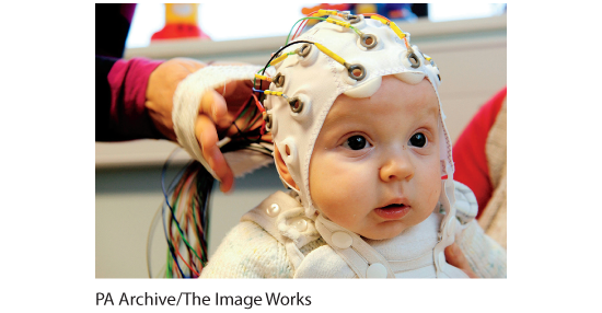 A photo of a baby wearing an electrode cap.