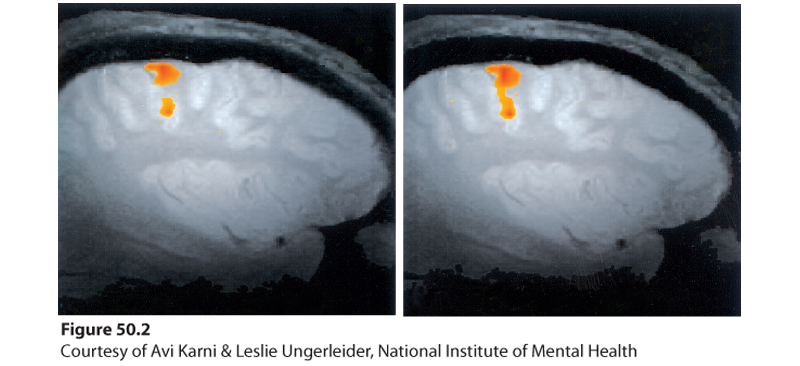 This image shows side-by-side brain scans of a brain before and after training.