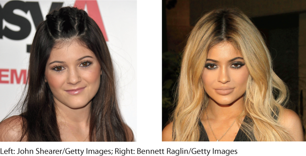 Two photos of Kylie Jenner before and after her cosmetic surgery.