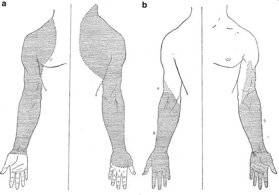 A324234_1_En_7_Fig5_HTML.gif