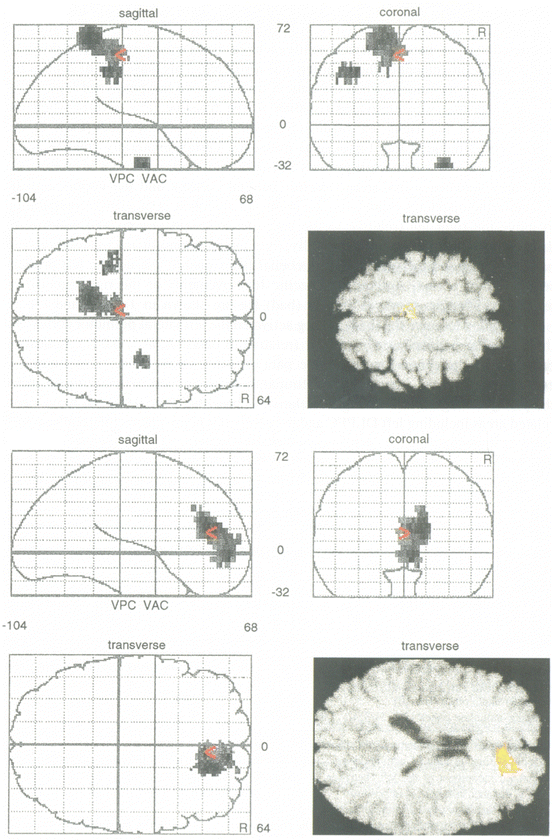 A324234_1_En_7_Fig9_HTML.gif