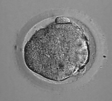 Figure 1.3. Frozen morula