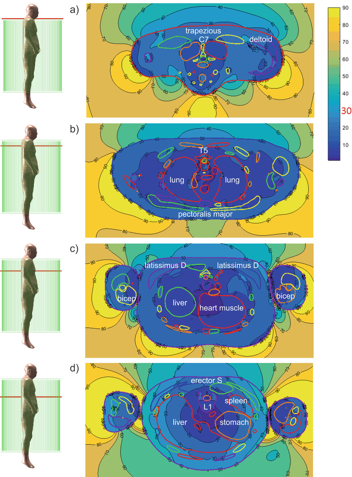 ../images/473436_1_En_5_Chapter/473436_1_En_5_Fig10a_HTML.png