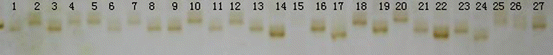 A454573_1_En_5_Fig2_HTML.gif