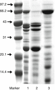 A454573_1_En_8_Fig3_HTML.gif