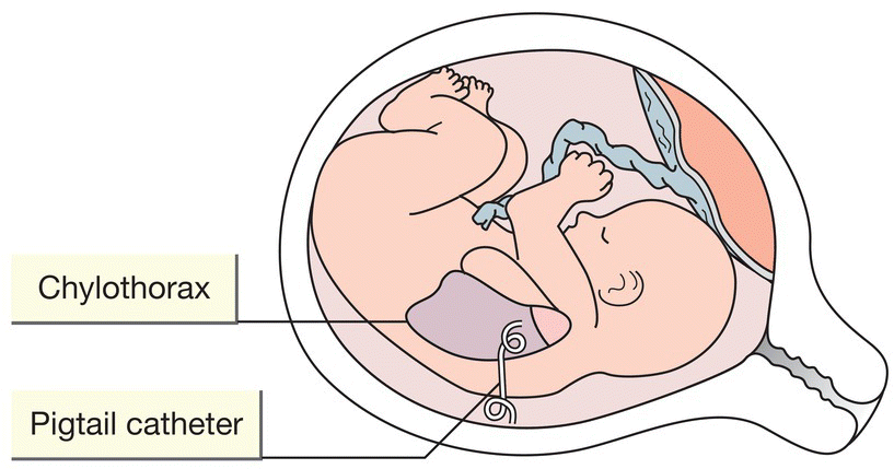 c4-fig-0005