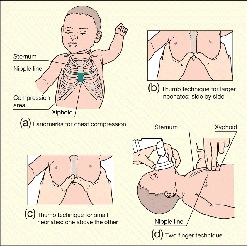 c13-fig-0003