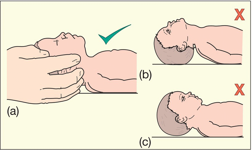 c13-fig-0005