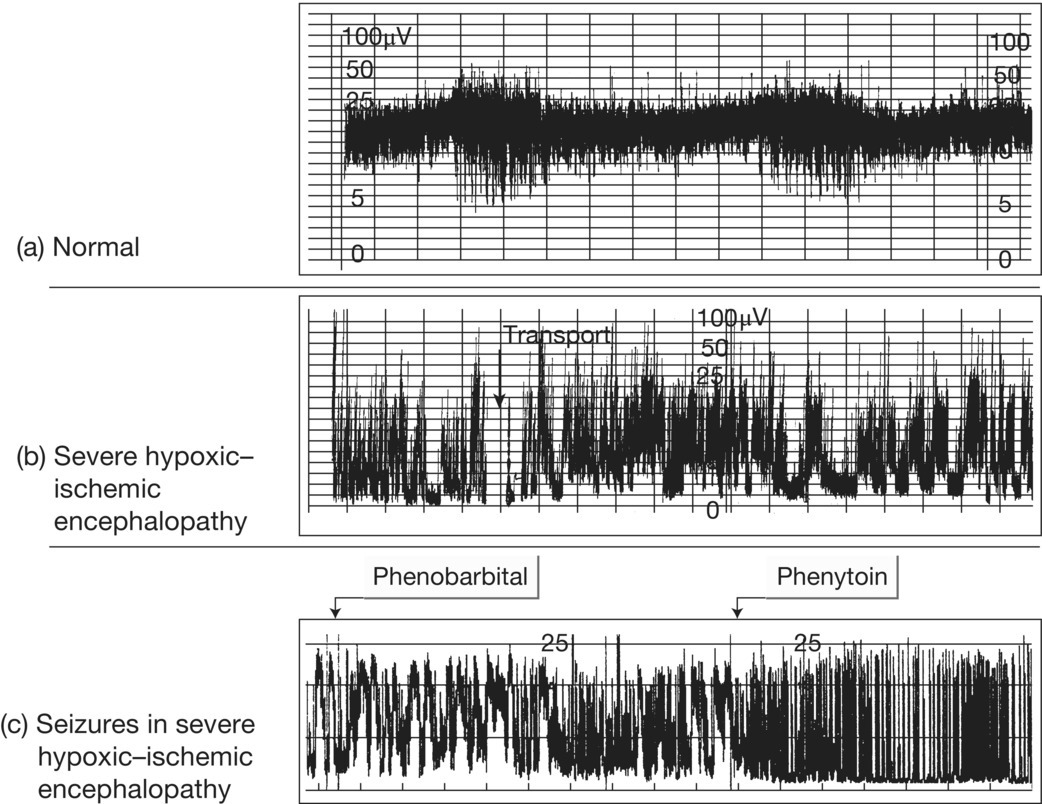 c14-fig-0004