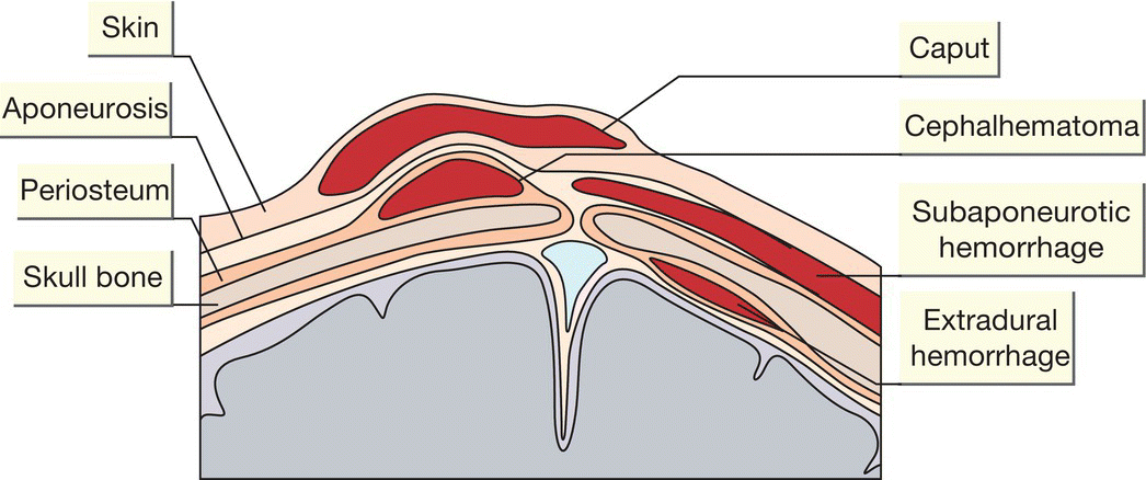 c15-fig-0001