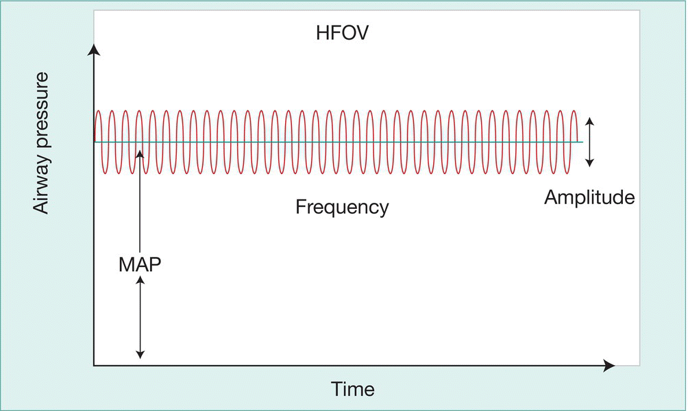 c26-fig-0011